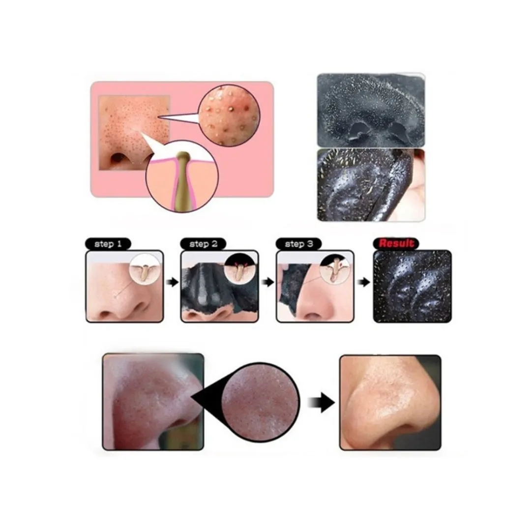 Black Mask – Máscara Preta Pontos Negros e Acne – 6g